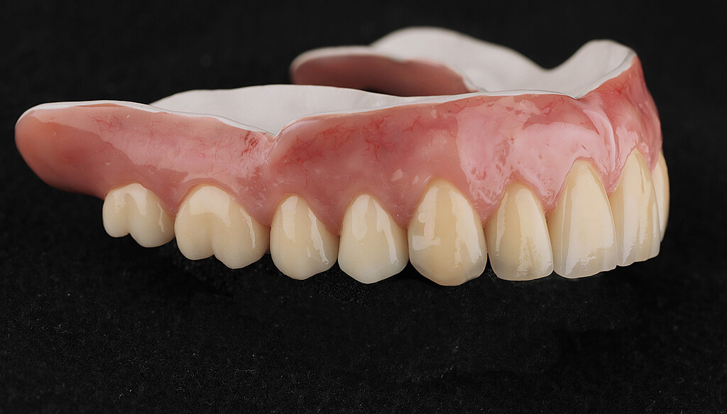 Clinical case with Pekkton® ivory. 