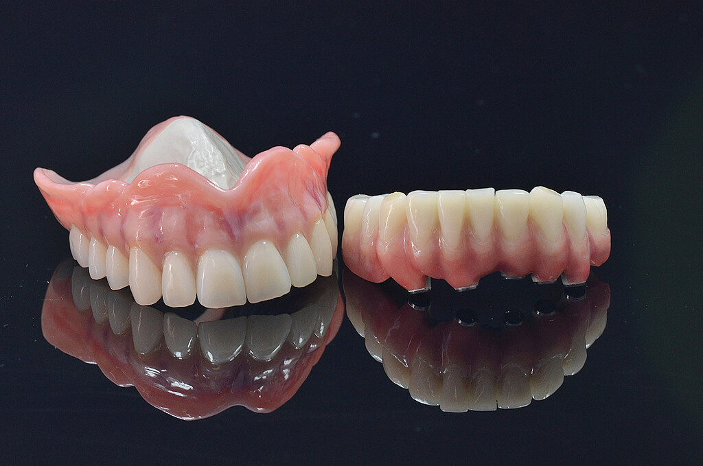 Clinical case with Pekkton® ivory. 